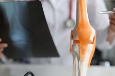 Postoperative Joint Replacements